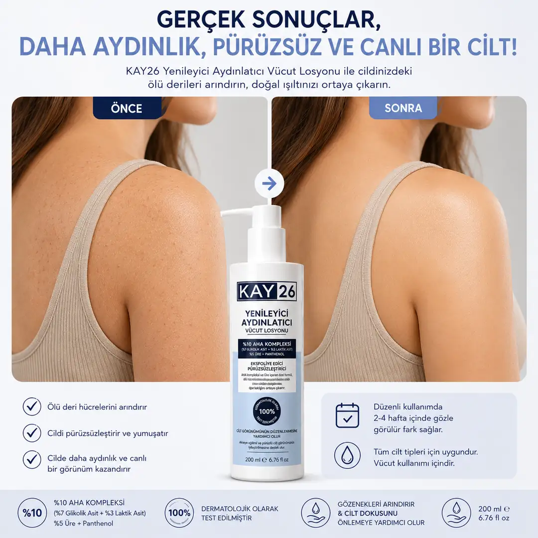 KAY26 YENİLEYİCİ AYDINLATICI VÜCUT LOSYONU - 10% AHA 4