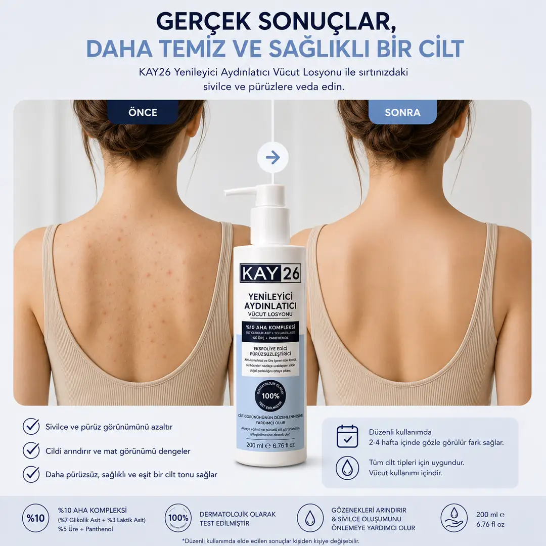 KAY26 YENİLEYİCİ AYDINLATICI VÜCUT LOSYONU - 10% AHA 3